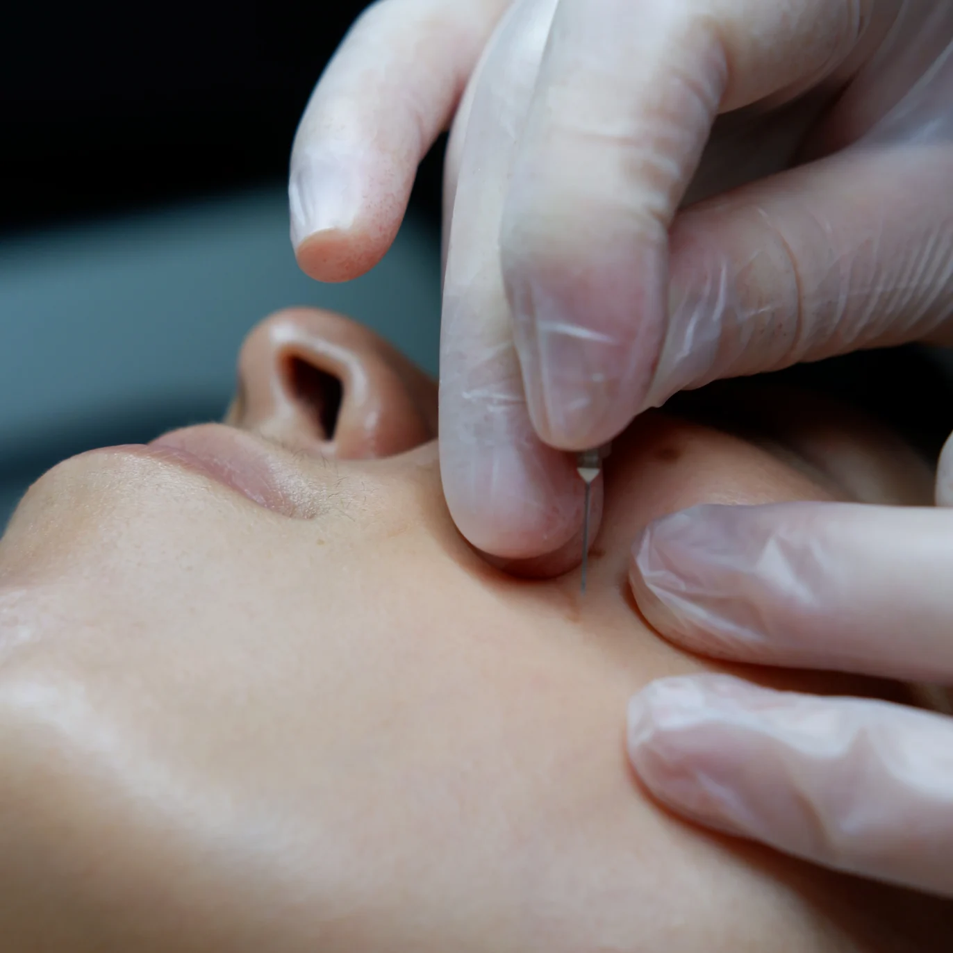 micro needling - buccal massage - jet peel - anti age facial - best facials london facial near me - skin treatments hydrafacial near me - face sculpting - beauty salon london - facials london - facemask