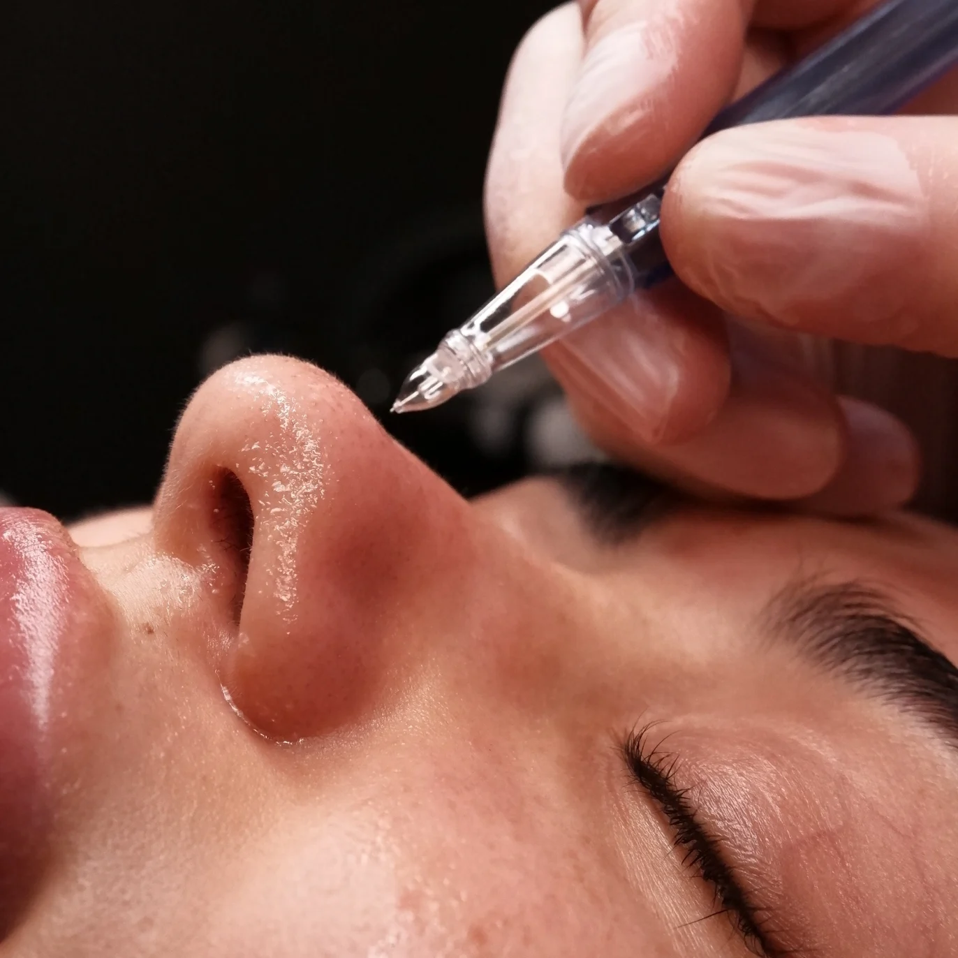 micro needling - buccal massage - jet peel - anti age facial - best facials london facial near me - skin treatments hydrafacial near me - face sculpting - beauty salon london - facials