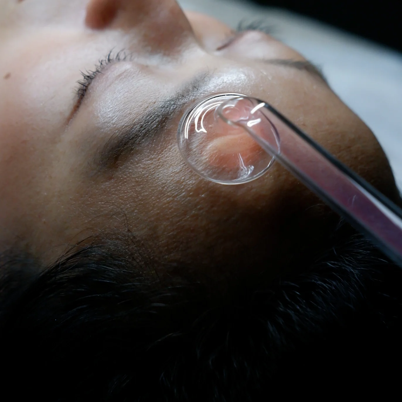 micro needling - buccal massage - jet peel - anti age facial - best facials london facial near me - skin treatments hydrafacial near me - face sculpting - beauty salon london - facials